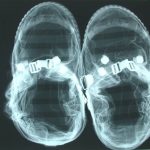 Neil Armstrong Preflight X-Ray of EVA Lunar Overshoes