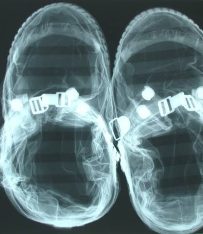 Neil Armstrong Preflight X-Ray of EVA Lunar Overshoes