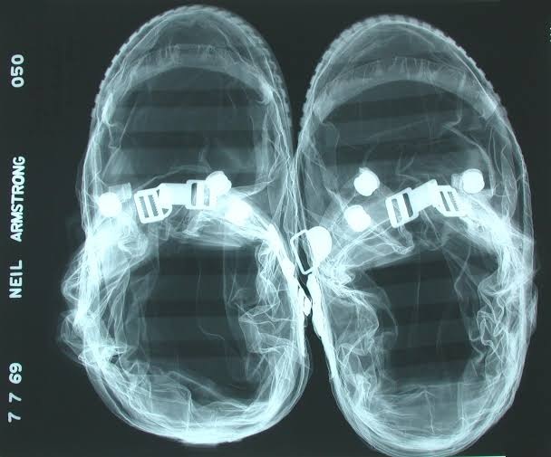 Neil Armstrong Preflight X-Ray of EVA Lunar Overshoes